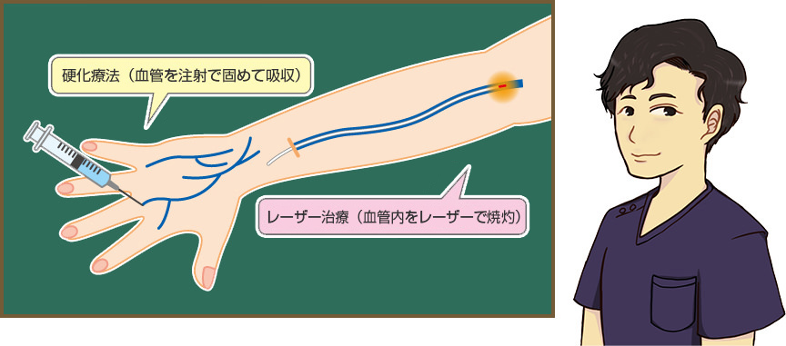伏見ウェルネスクリニックの治療法 KS式ハンドベインキュア