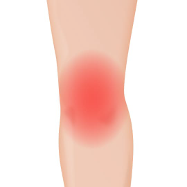 膝の痛みを改善する