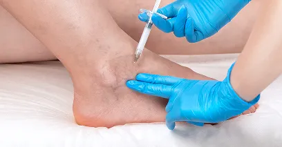 目立つ血管だけピンポイントで治療できる