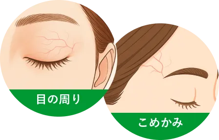 目の周り・こめかみ