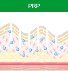 PRPが肌の奥に浸透します。