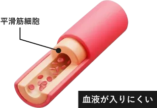 平滑筋の締め付けが強い血管