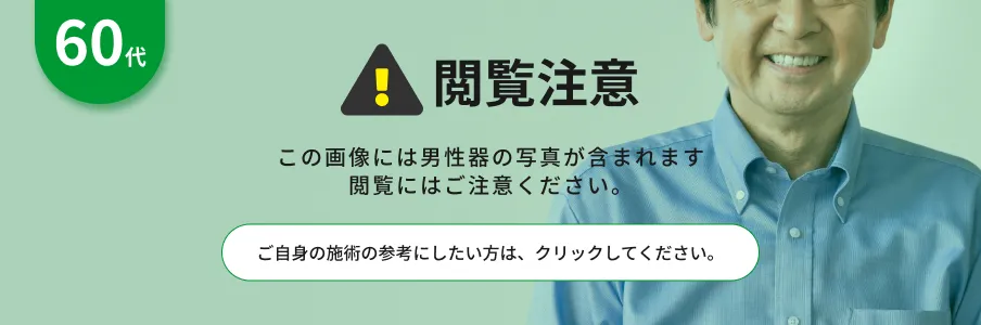 閲覧注意