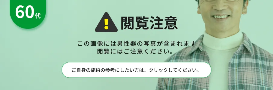 閲覧注意