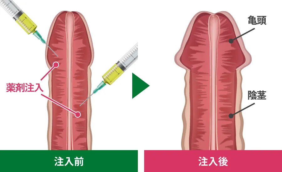 亀頭、陰茎増大効果
