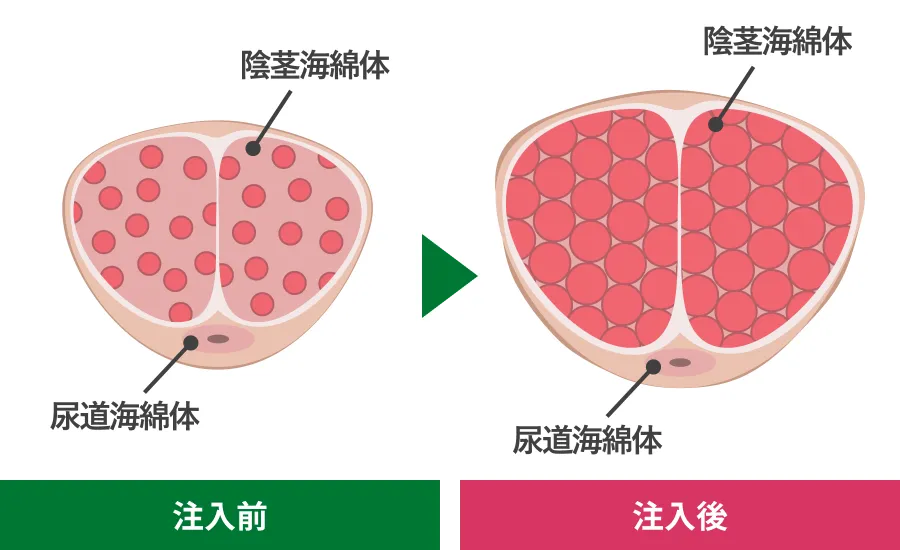 血管性勃起障害を改善