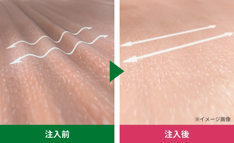 見た目を若々しい印象へ