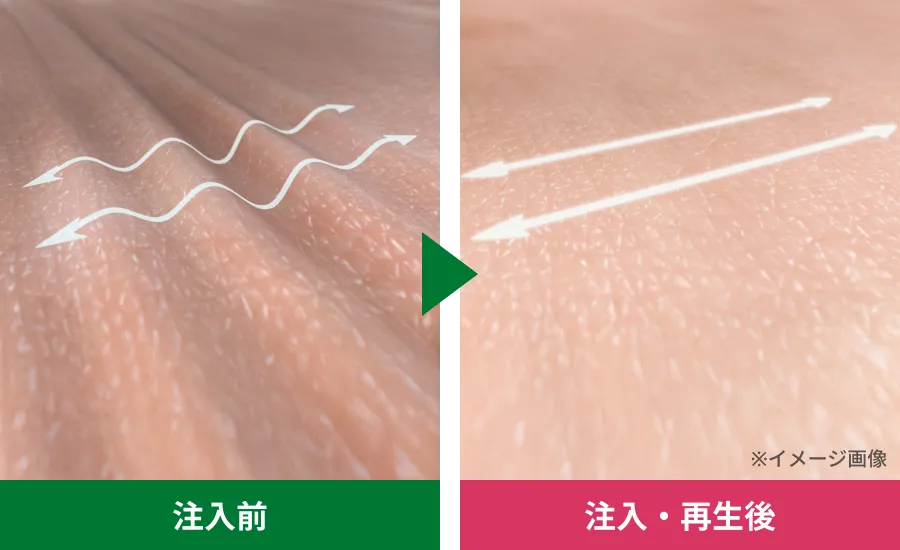 見た目を若々しい印象へ