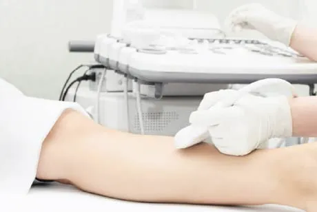 超音波エコー検査で下肢静脈瘤を診断する医師