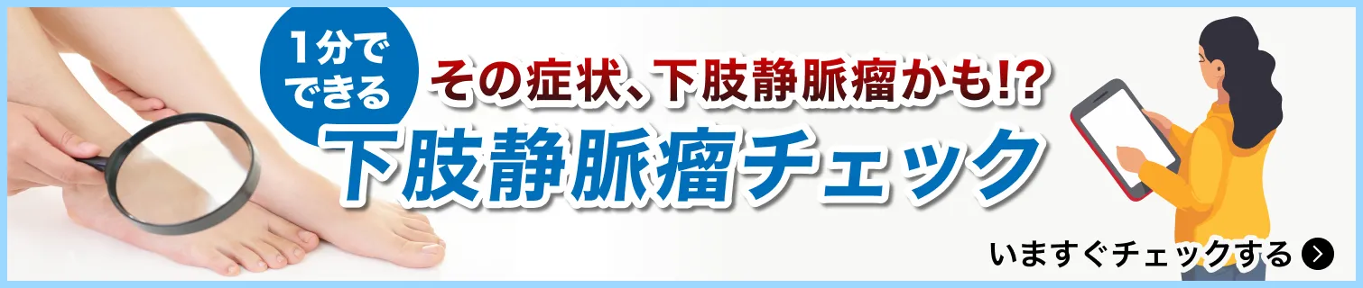 下肢静脈瘤セルフチェックバナー
