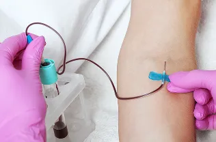PRP作製のための採血