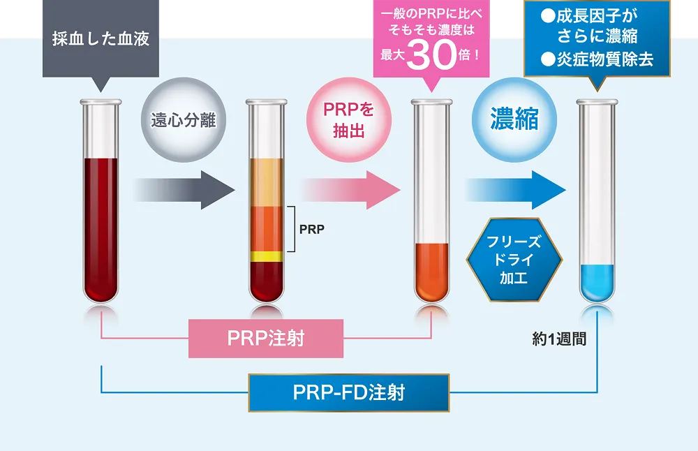 PRP注射とPRP-FD注射の違い