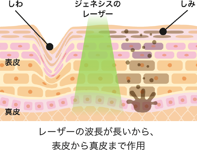 シワ、赤ら顔、毛穴の開きなどの肌のお悩みをまとめて解消