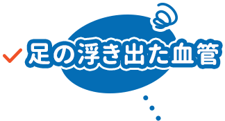 足の浮き出た血管