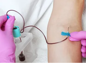 PRP作製のための採血
