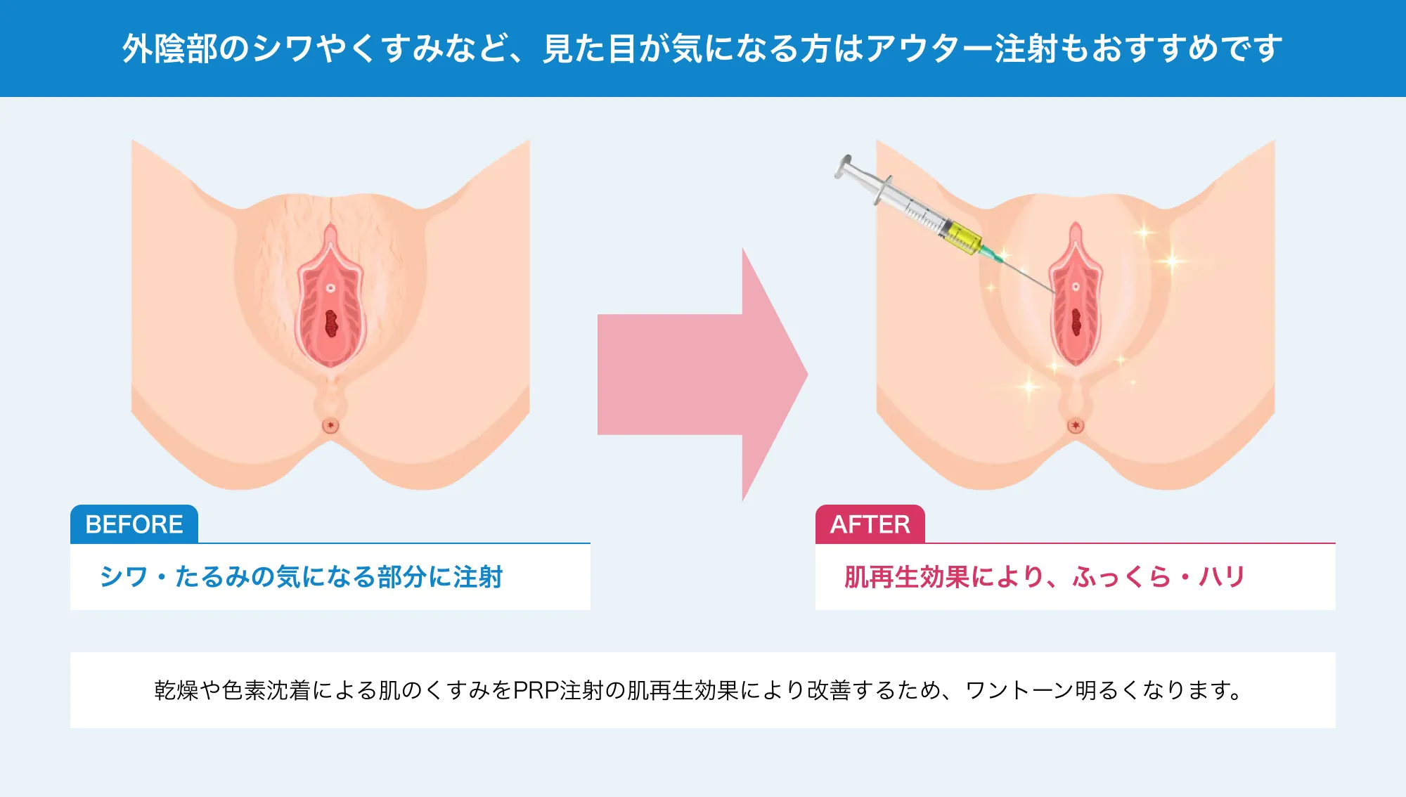 肌再生効果により、ふっくら・ハリ