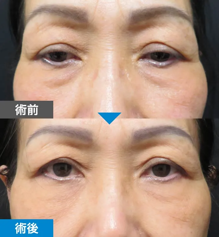 症例 01 術前・術後