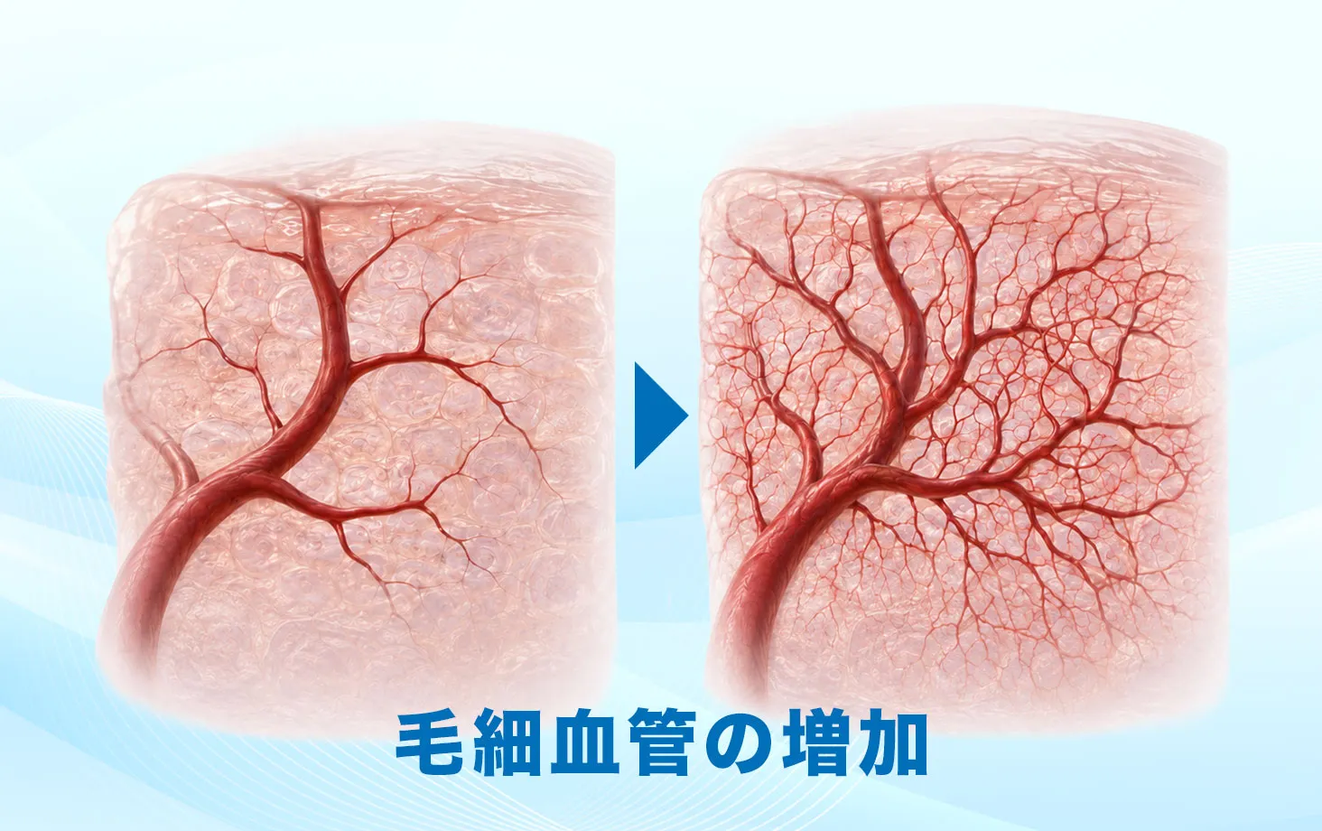 衝撃波治療(低出力衝撃波)による毛細血管増加のイメージ図