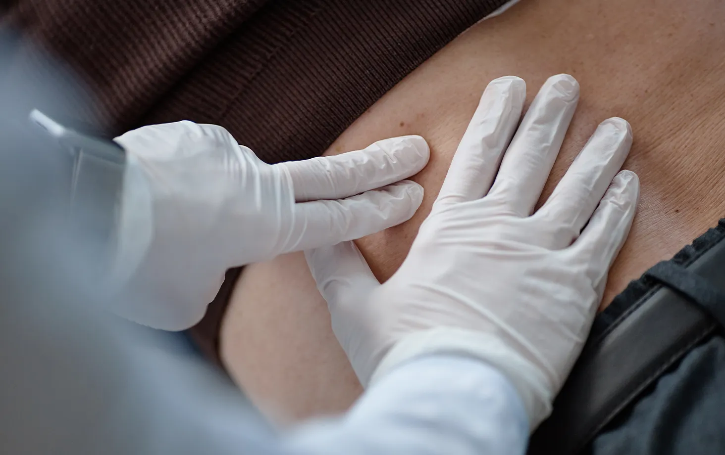 手袋をした医師が患者の下腹部を触診している様子