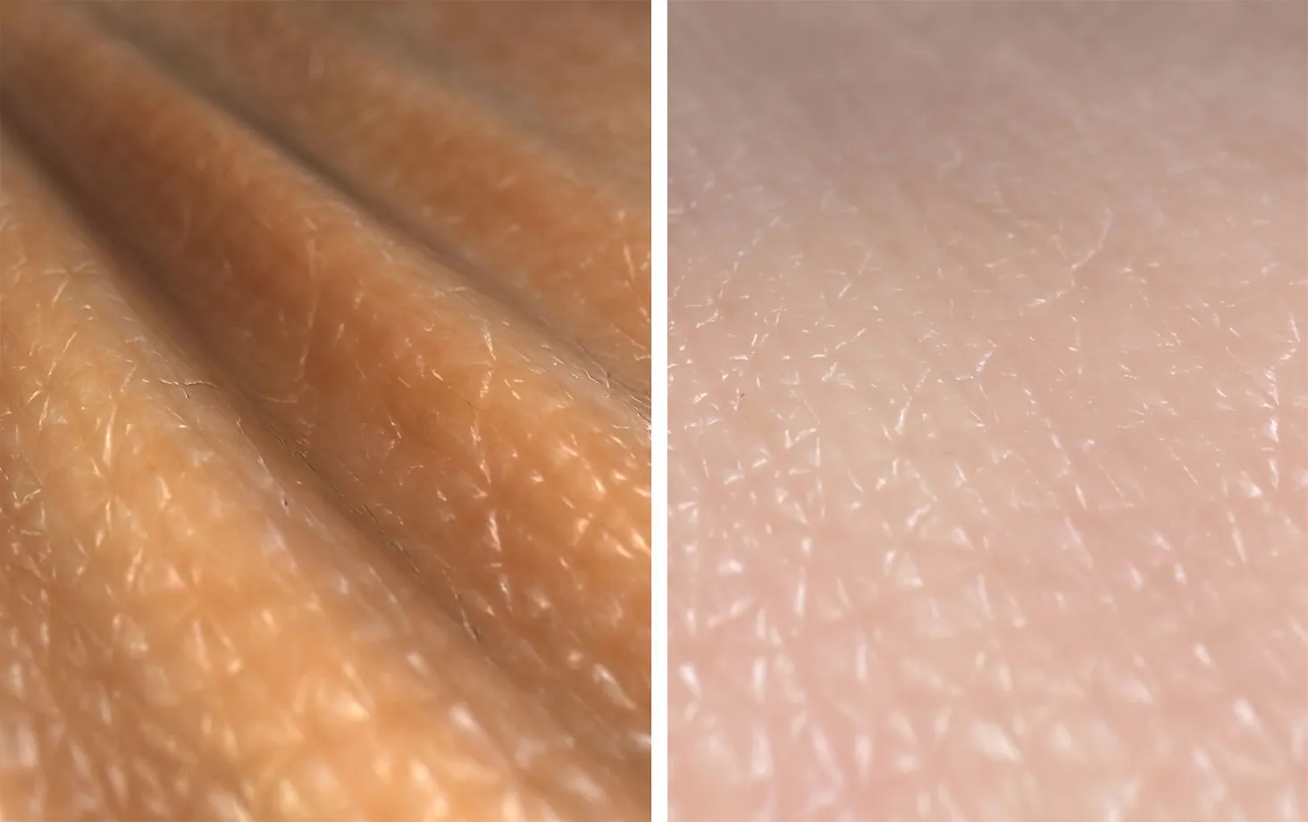 シワのある皮膚と、なめらかな皮膚を並べた写真